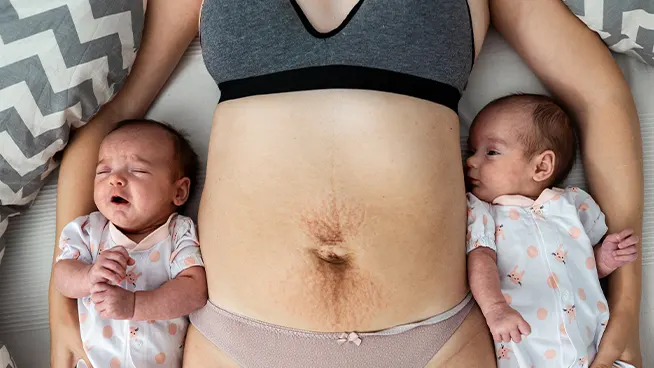 Mom with stretch marks laying with babies on either side of her