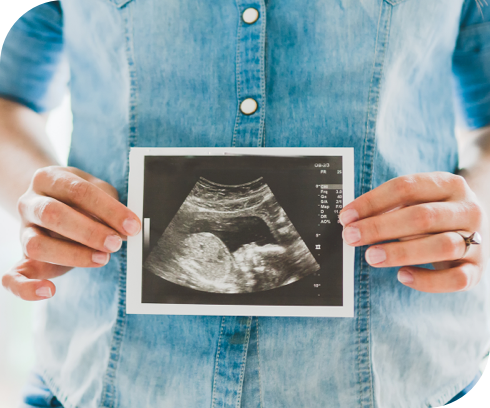 Pregnant woman holding up sonogram