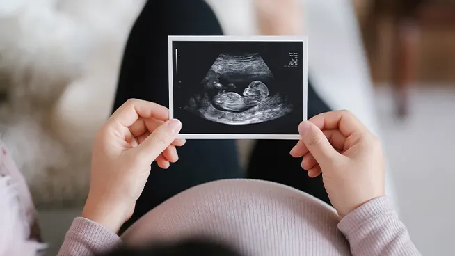 Pregnant woman looking at ultrasound image